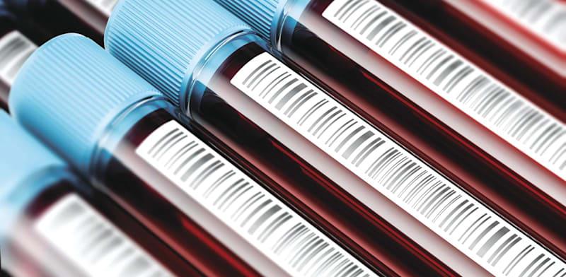 אילוסטרציה של דגימות דם / צילום: Shutterstock אילוסטרציה של דגימות דם / צילום: Shutterstock